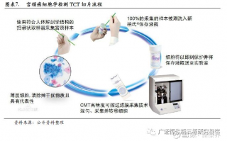 AI TCT，癌TcT