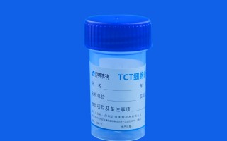 时间压缩技术(tct)，时间压缩技术管理方式的应用